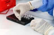 MINSA DESMIENTE QUE PERÚ RECHAZÓ DONACIÓN DE 500,000 PRUEBAS RÁPIDAS DE CHINA